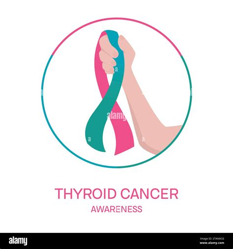 Thyroid Cancer Conceptual Illustration Stock Photo Alamy