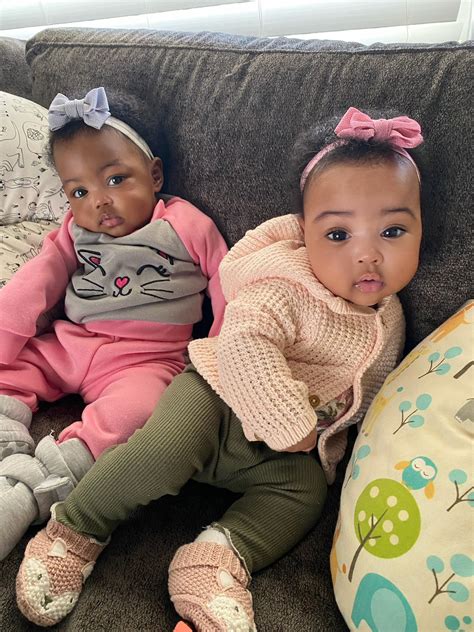 Photo Of Adorable Twin Girls Born With Different Skin Tones And Are