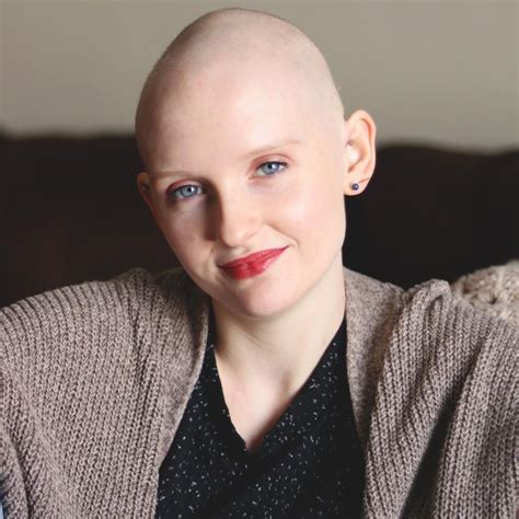 Albums Pictures Pictures Of Bald Woman Latest
