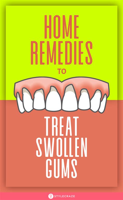 14 Home Remedies To Treat Swollen Gums Causes And Prevention