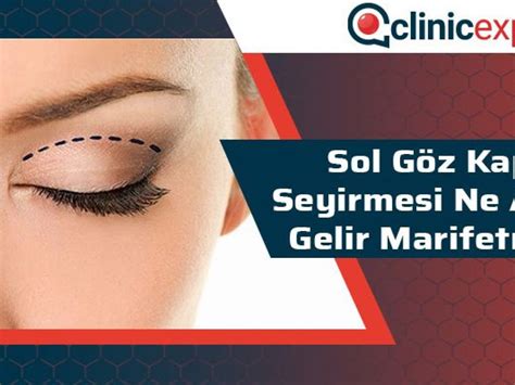 sözlü susuzluk şarkıcı göz seyirmesi ne anlama gelir geçit karar dilekçe