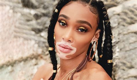 Winnie Harlow A Most Exceptional Woman Dolce Luxury Magazine