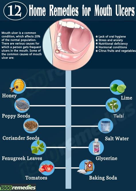 Mouth ulcers can be caused due to a number of reasons. What Are Some of the Best Natural Cures For Acne? | Ulcer ...