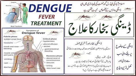 Dengue Bukhar Ka Ilaj | Dengue Fever Ka IIaj | Home Remedies For Dengue