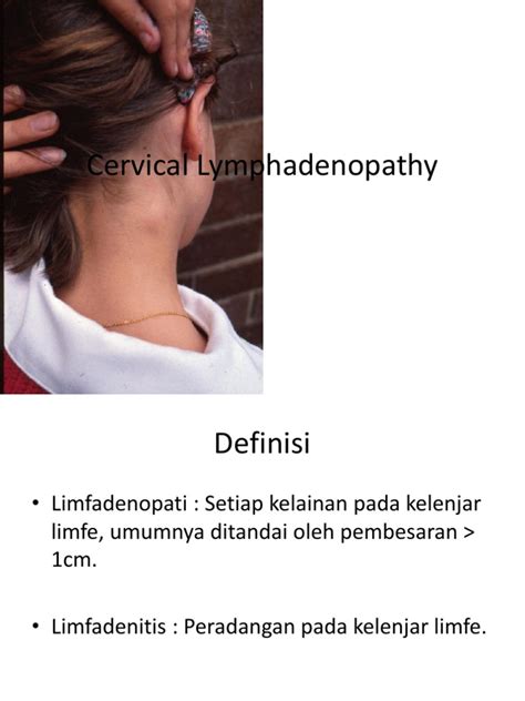 Cervical Lymphadenopathy