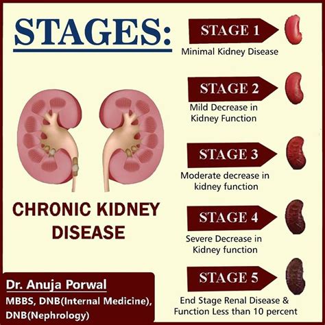 Stages Of Chronic Kidney Disease Kidney Disease Kidney Disease