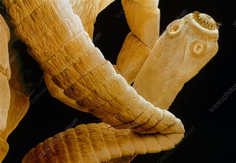 Coloured Sem Of A Tapeworm Taenia Sp Stock Image Z1650046