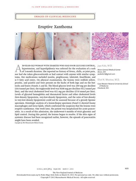 Eruptive Xanthoma Images In Clinical Medicine Pdf Diseases And