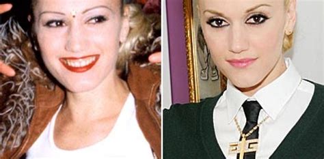 Gwen Stefani Nose Job Plastic Surgery Before And After Photos