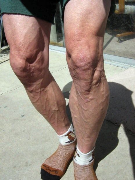 Bald Legged And Beautiful Men Who Shave Their Legs In The Name Of Sport Health And Fitness