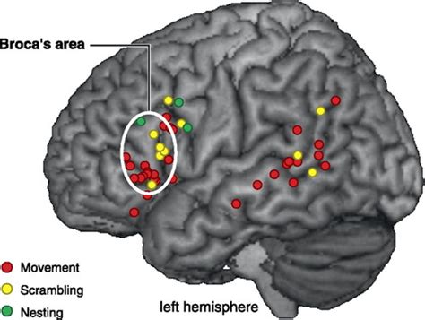 The Brain Basis Of Language Processing From Structure To Function