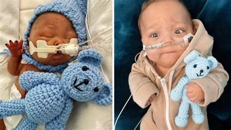 Miracle Premature Baby Born At 6 Months Survives After Parents Refused