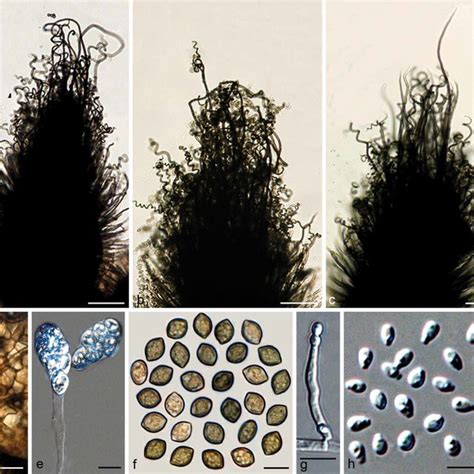 Typical Morphology Of Chaetomium Globosum Sensu Stricto 1 Cbs 16062