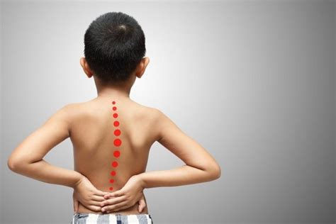 Backpain In Kids Causes And When To Worry Dr Yash Shah