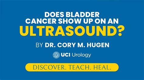 Does Bladder Cancer Show Up On An Ultrasound By Dr Cory Hugen Uci