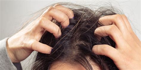 5 Common Causes And Treatments For An Itchy Scalp