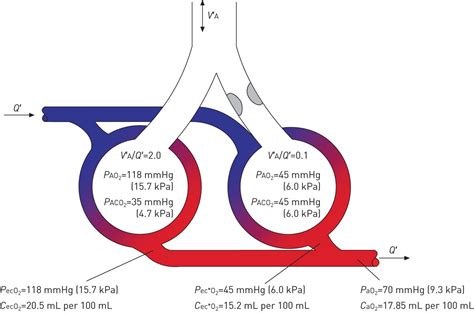 Gas Exchange And Ventilationperfusion Relationships In The Lung