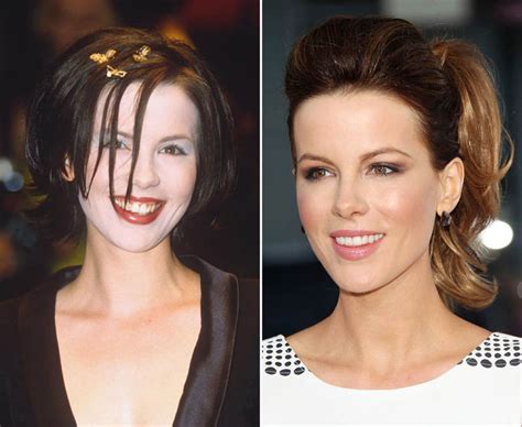 Kate Beckinsale With Her Hollywood Smile Celebrity Teeth