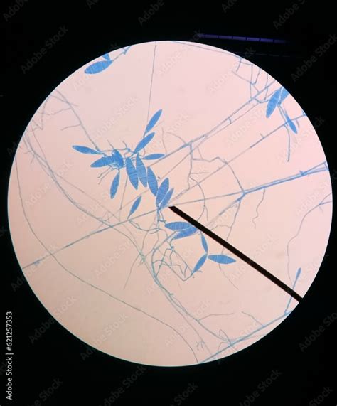 Microscopy Of Microsporum Gypseum Microsporum Gypseum Microconidia
