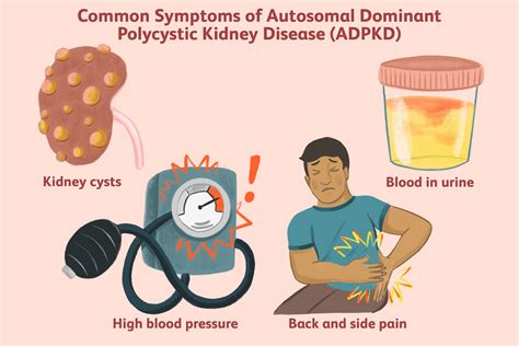 Autosomal Dominant Polycystic Kidney Disease Symptoms And Causes