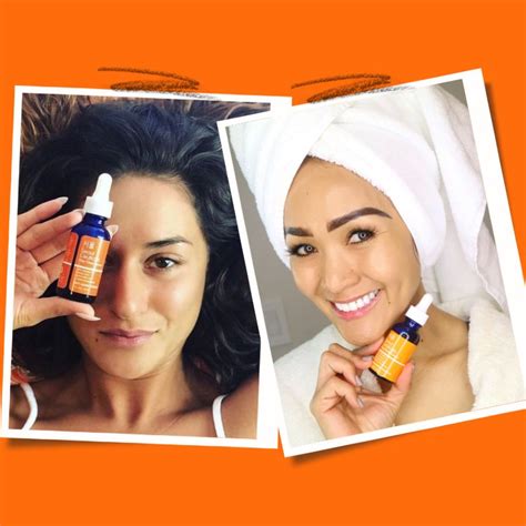 Kojic Acid Serum Explained Why This Beauty Product Has Become So Popular
