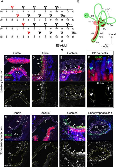 Zikv Infects Sensory And Non Sensory Epithelia Of The Inner Ear A