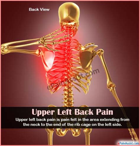 Upper Left Back Paincausessymptomstreatmentdiagnosis