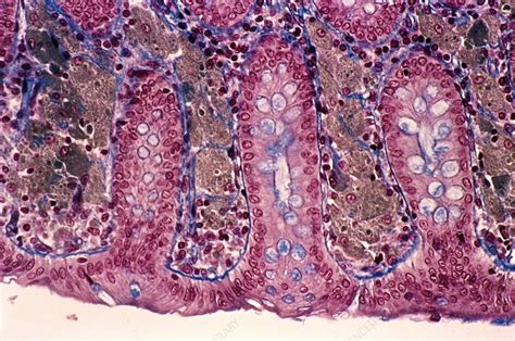 Melanosis Coli Light Micrograph Stock Image C0215167 Science