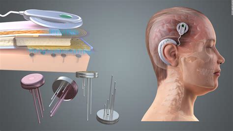 Brain Implants Could Give Governments And Companies Power To Read Your