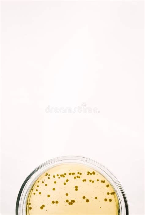 Li Escherichia Bacteria On Yellow Agar Plate Stock Photo Image Of