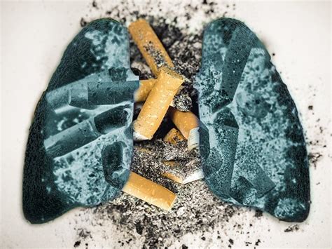Lung Diseases Caused By Smoking Symptoms Treatments And More