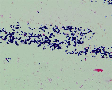 Gram positive cells would be colorless. Gram stain of a blood culture indicates the presence of ...