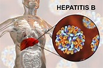 Do you, or someone you know have chronic hepatitis b? Want to help ...