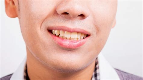 Bloomfield Hills Tooth Discoloration Causes And Remedies Bright Side