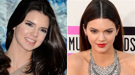 Has Kendall Jenner Had A Nose Job Reality Stars Thinner Features