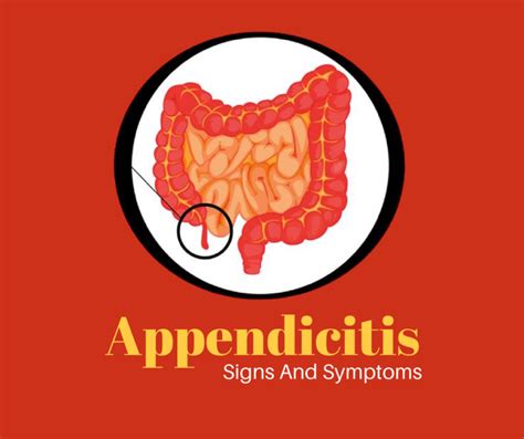 What Are The Common Signs And Symptoms Of Appendicitis Varanasi Hospital
