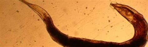 Worm Infections Symptoms In Adults Diagnosis And Treatment Toxic Off