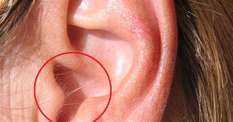 Having Hair In Your Ear Is A Warning Sign What Does It Mean