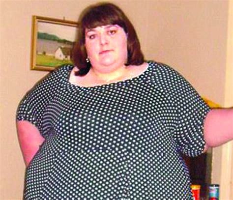 How Britains Fattest Woman Lost 18 Stone The Asian Age Online