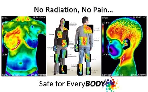 Full Body Scan By De Novo Scan Clinical Thermography In Scottsdale Az