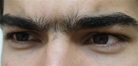 This Is Why People Have Unibrows Science Says