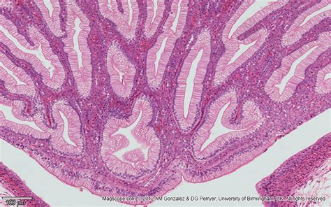 Renal Papilla What Function Does A Calyx Perform In The Kidneys