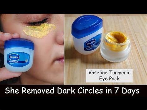 She Removed Dark Circles Eye WRINKLES In 7 Days Vaseline Turmeric