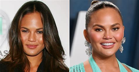 Chrissy Teigen Before And After Did The Model Get Plastic Surgery