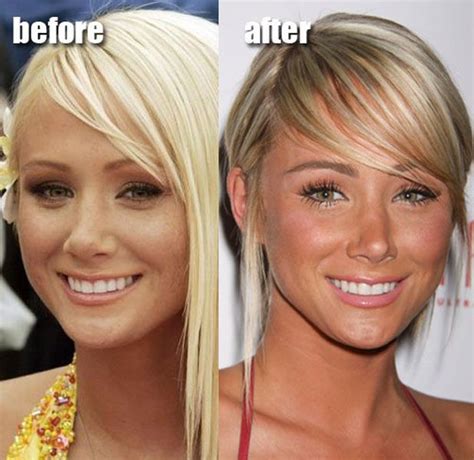 Sara Underwood Plastic Surgery Before After Celebrity Plastic Surgery Plastic Surgery