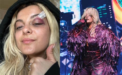 video bebe rexha hit in face with phone thrown by fan while performing