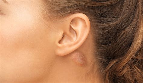 What You Need To Know About That Lump Behind Your Ear Curejoy