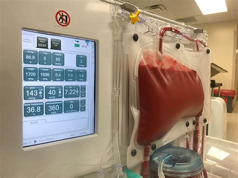Uab News Surgeons Perform Alabamas First Liver Transplant Using A