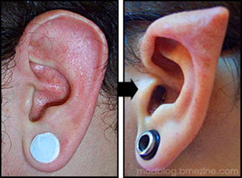 And how much would it cost? Another New Body Modification. Elf Ears. - Gallery | eBaum ...