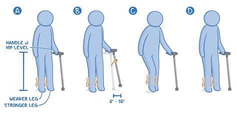 Assistive Devices For Ambulation Clinical Skills Notes Osmosis